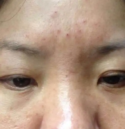 解读山根有横纹所象征的事业运好坏