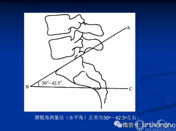 6腰骶角的测量5腰椎曲度4颈椎曲度3腰椎2颈椎1寰枢椎的判读一美式影像