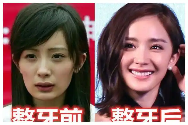 有种差距叫"明星整牙", 杨幂气质, 而她堪比"整容"