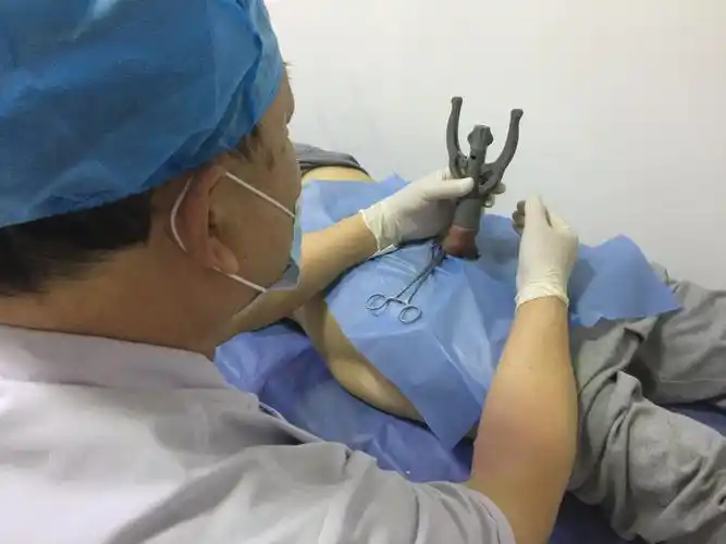 一次性包皮环切缝合器手术图 - 好大夫在线