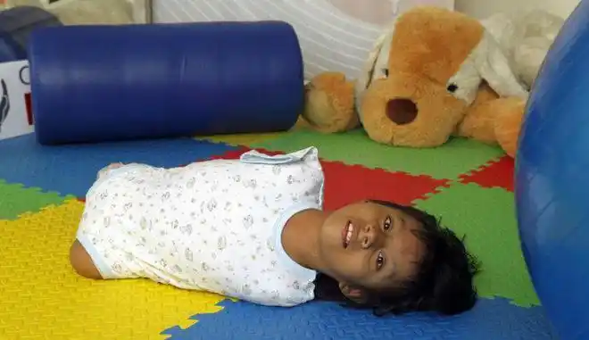 直击8张罕见的四肢全无女孩的催泪照_网易订阅