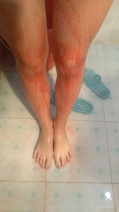 血崩是一种什么样的体验
