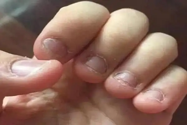 宝宝爱啃指甲,妈妈知道吗?