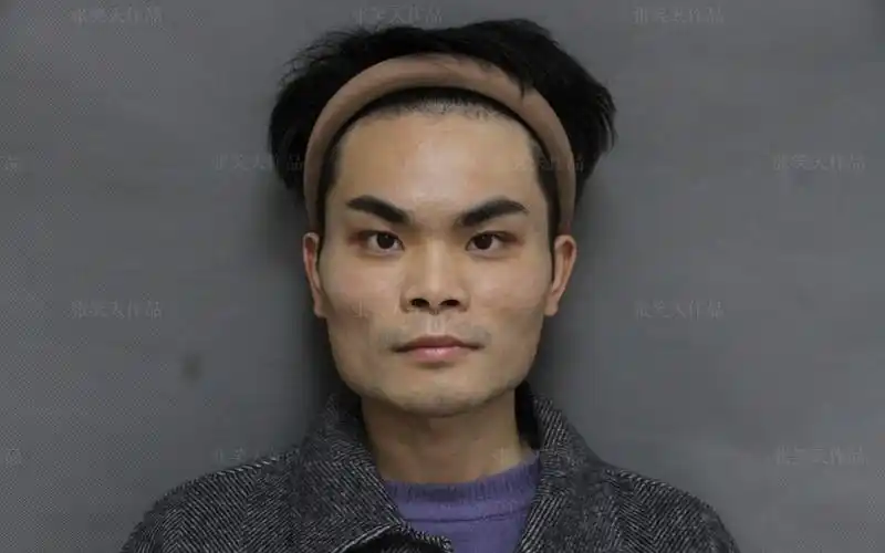 不对称!颧骨突出!男生方脸怎么办?