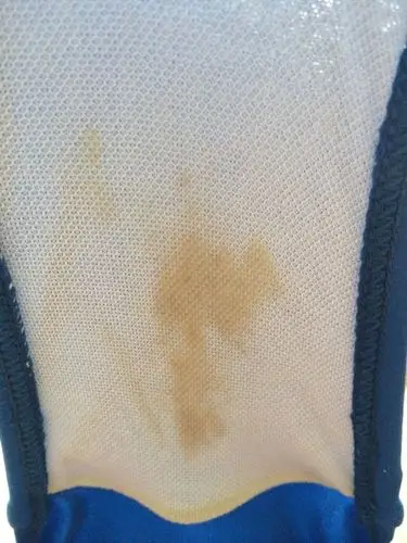 怀孕初期分泌物图片