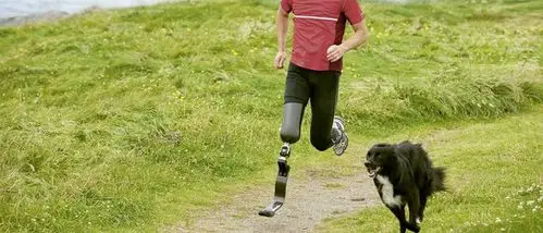 碳纤维复合材料应用于康复假肢中的优势