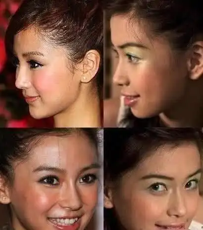 杨颖15岁丑照曝光被质疑整容,回应:早知道整牙时不拍那么多照片