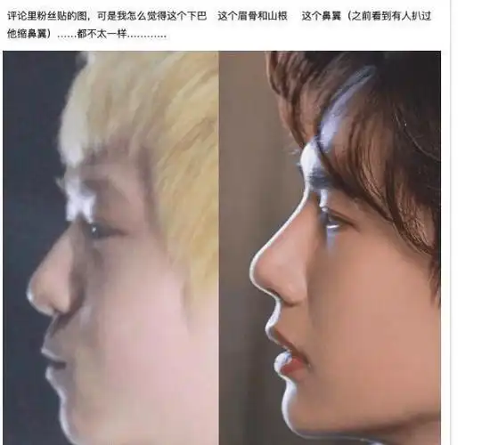王一博再陷整容风波,14岁旧照被扒鼻子遭吐槽,网友指其判若两人_照片