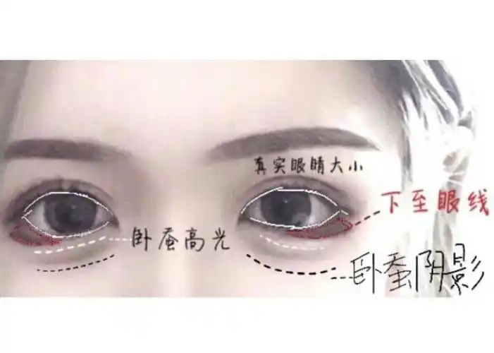 下眼睑下至手术的优缺点有哪些?