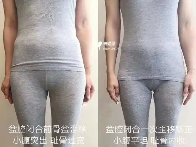 生完宝宝就发现体型变了