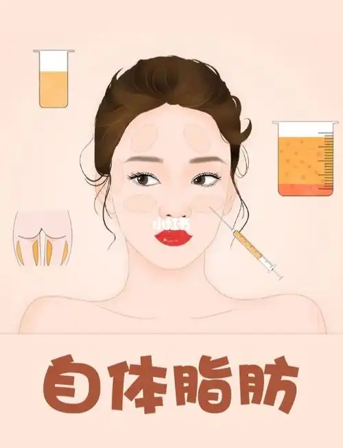 网红收割机自体脂肪填充