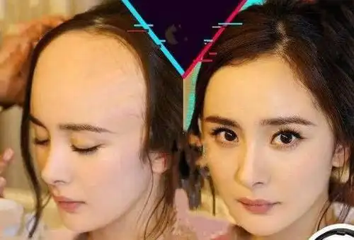 中,大幂幂的发际线又回来了,网友纷纷表示不敢相信:是去植发了吗?