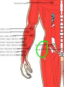 体育课单腿跳损伤了,我的右大腿根部侧身肿_有问必答_快速问医生