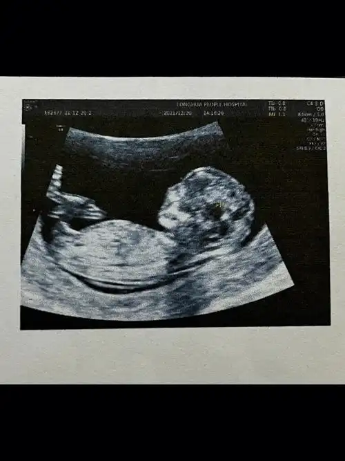 nt过了7813w正式成为二胎孕妈一枚70