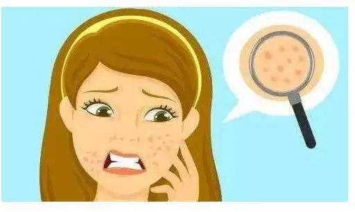 毛孔粗大是什么引起的 预防皮肤毛孔粗大的5个要点