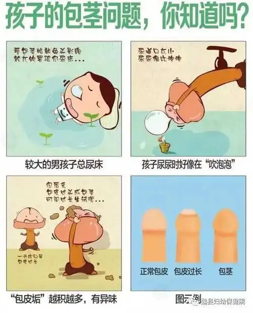 做包皮手术最佳年龄是多大