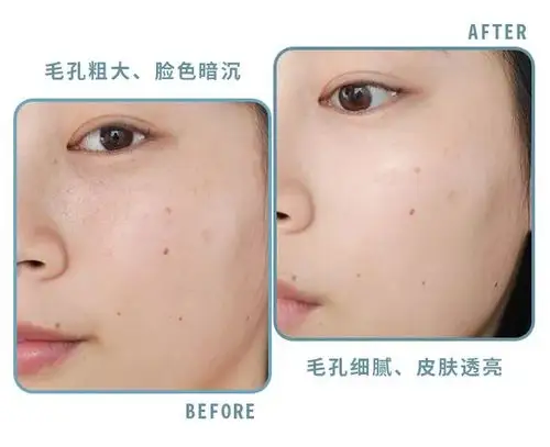 5%阿魏酸,它们可以协同合作,一起帮助皮肤中和体内的自由基,提升抗