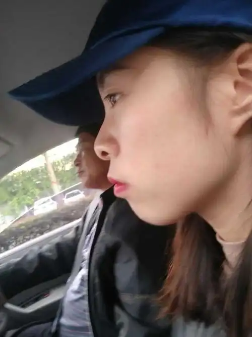 牙齿畸形 嘴唇外凸 塌鼻梁 扁额头 所有缺点全暴露出来了 以至于从来