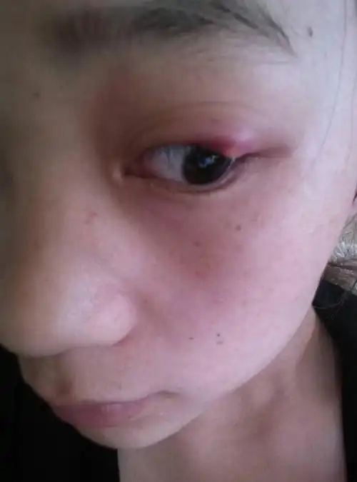 肚脐左边5-6公分,在肋骨下面1公分的地方轻微的酸疼,感觉好像还有.