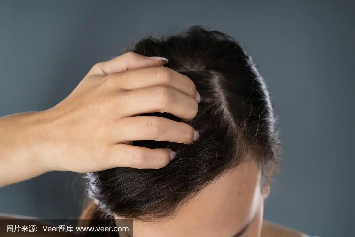 一个女人在挠她发痒的头