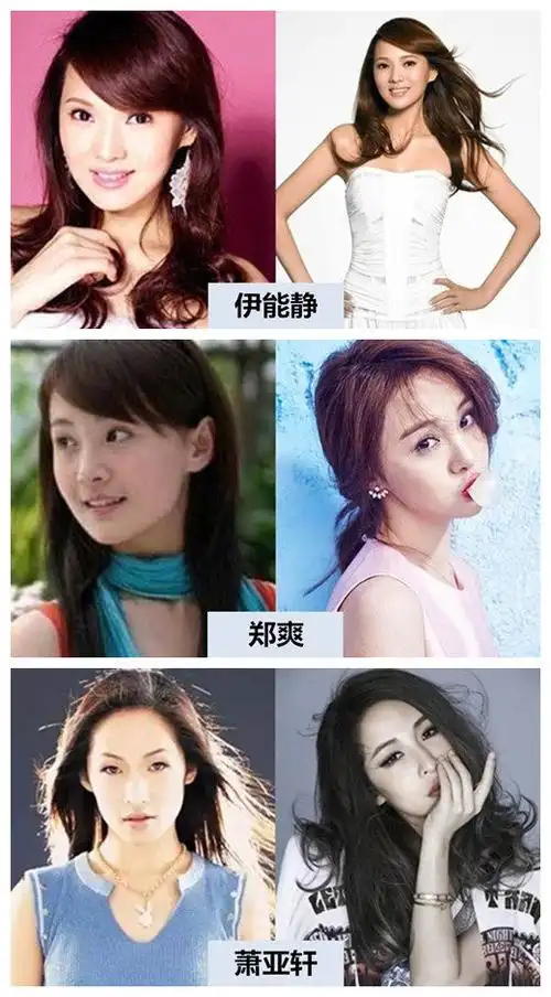 盘点明星整容前后对比照 微整形还是选韩国id医院(安青网)