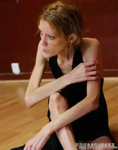 骨瘦如柴别让任何人定义你的人生