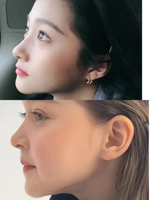 还是薯宝们厉害一看侧脸更像大美女关晓彤