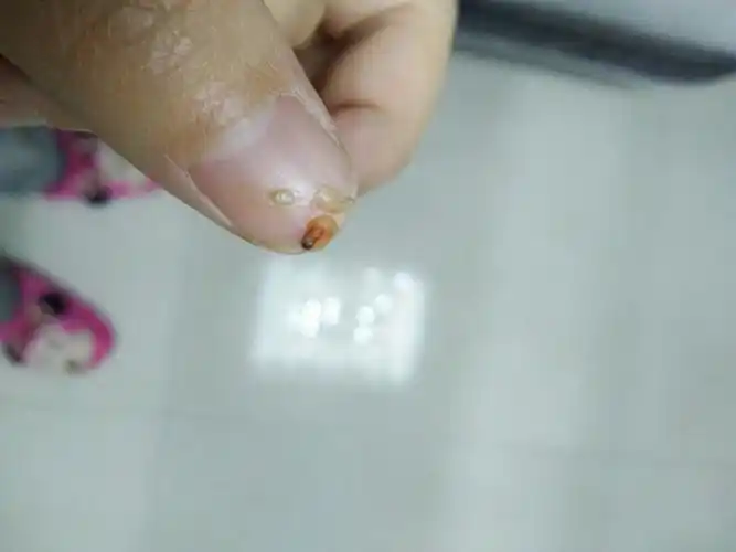 看看是不是身体里有虫子了.