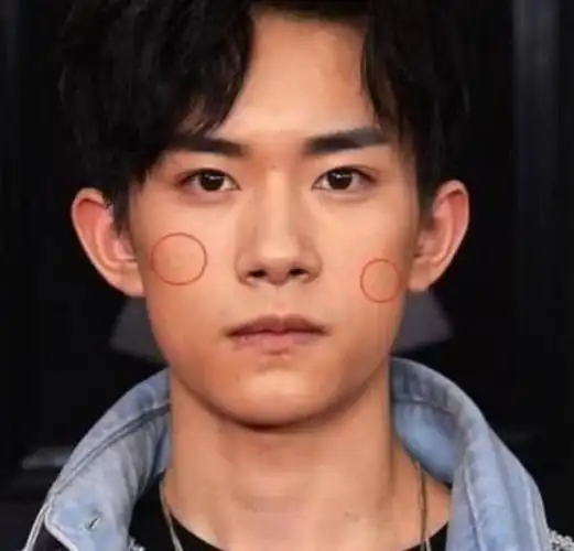 4位明星脸上的疤痕,易烊千玺打架,杨幂爬树,而他最让人心疼!