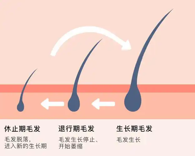 就是正常的掉发脱落给"新人"机会势必会有一部分头发进入休止期如果新