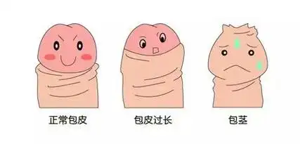 出现了包皮过长或者包茎,出现了感染,影响了排尿,才趁暑假来割包皮的