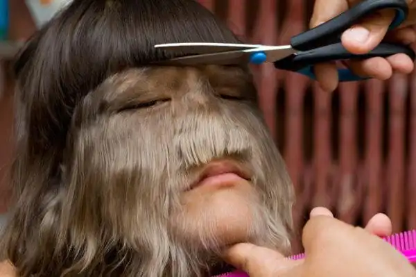 世界最恐怖变异人 男孩腹部长出连体手腿