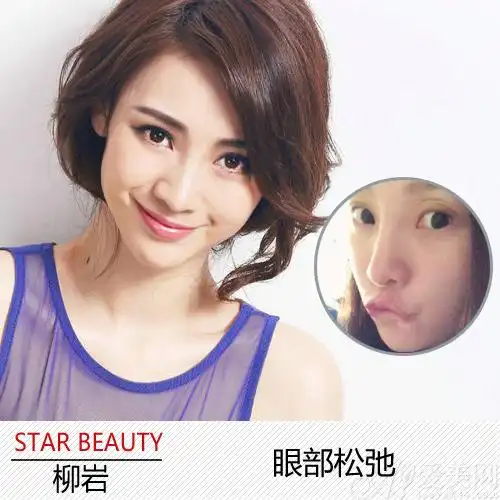 柳岩晒素颜照 浓妆女星卸妆后谁美谁残