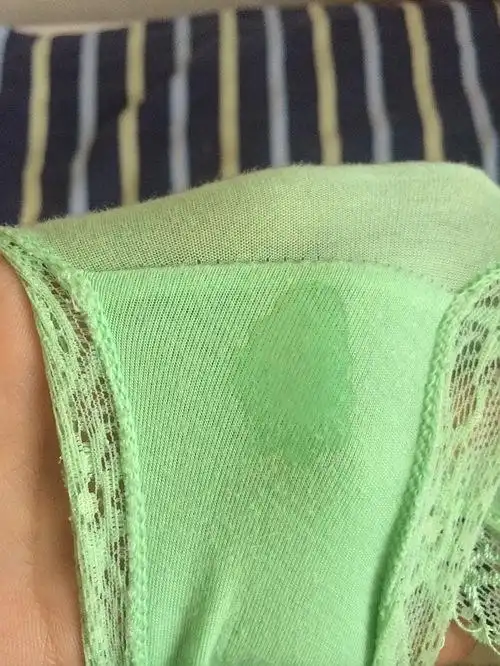 我附图了 有经验的姑娘们帮我看看啊 最近白带就这种 像水一样 也有点