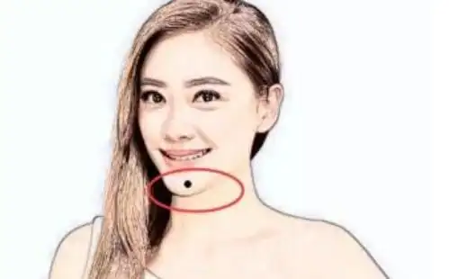 五种克夫痣,最好一个都没有_女人