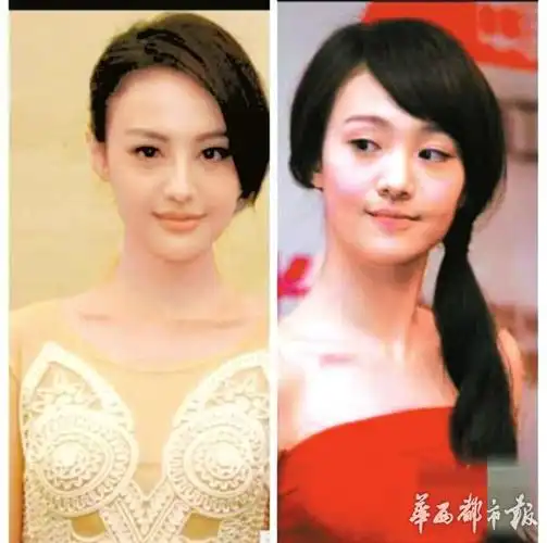 郑爽被指整容前后的对比照片.
