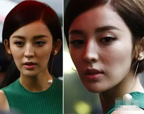 作为暴瘦届的前辈比娜扎瘦的还夸张,一样高耸突出的颧骨凹陷的脸颊