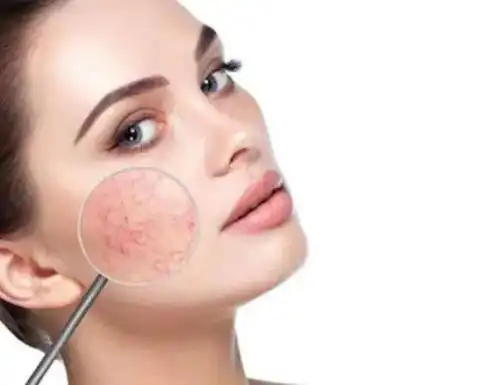 脸部出现这些变化,有可能是"敏感肌",方法有这3个!_皮肤