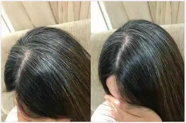 白发能调理成黑发可能吗怎么调理白头发变黑头发