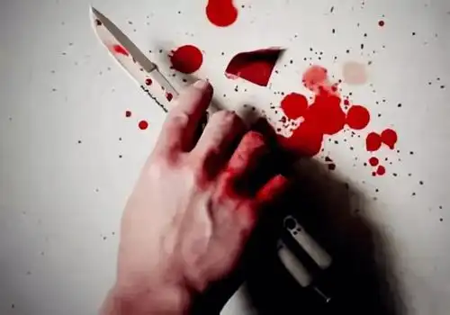 安徽丨咋回事丈夫拿刀当着孩子的面朝妻子头部和胳膊乱砍竟只是因为