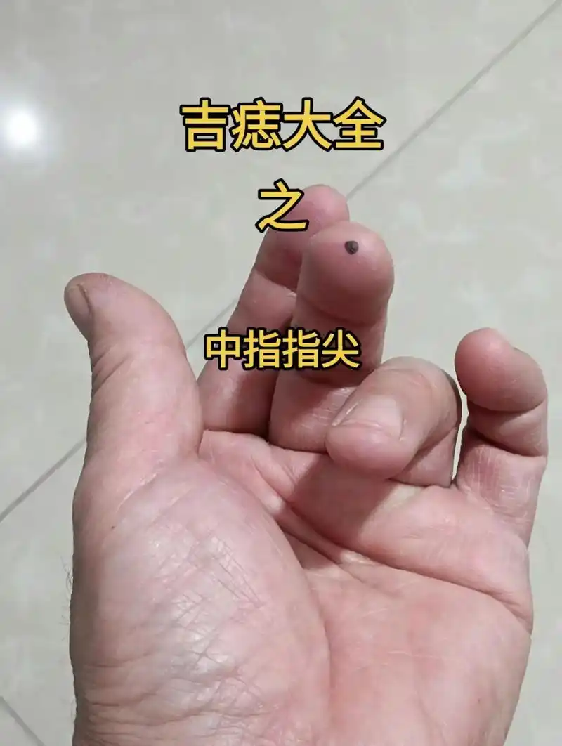 中指指尖有痣者,才智过人,能在学业和事业中都取得不错的成绩# - 抖音