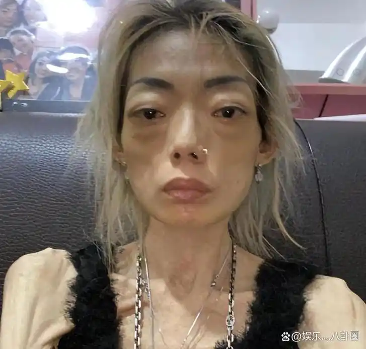 豪门玩物,几年被折磨成牙齿全脱落,不足80斤,半人半鬼惨不忍睹