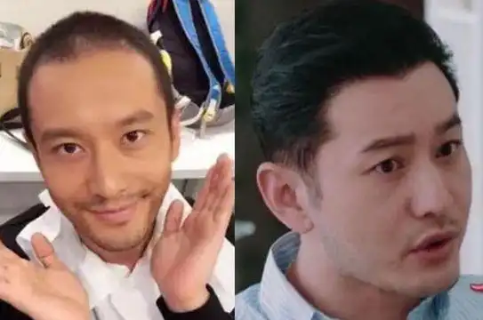 黄晓明一秃老30岁,为拍戏暴瘦25斤,秃头造型好吓人 - 知乎