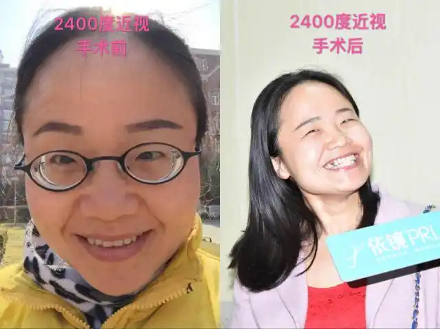 王晓瑛教授用依镜prl为超高度近视患者点亮人生光彩