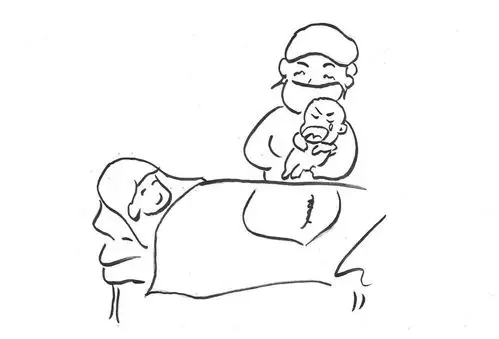 太真实了!生娃过程大揭秘!别再说"不就是生个孩子吗!