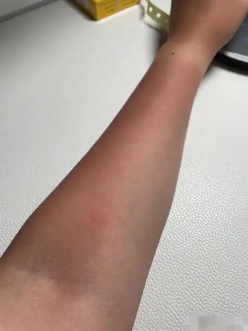 央视记者追踪大象被晒黑!云南的紫外线到底有多强?笑cry