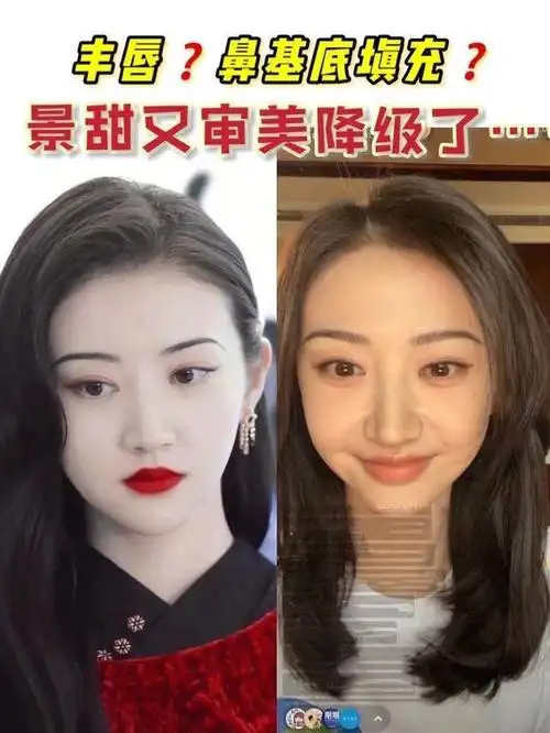 粉丝不让do脸就及时收手修复了双眼皮吗?