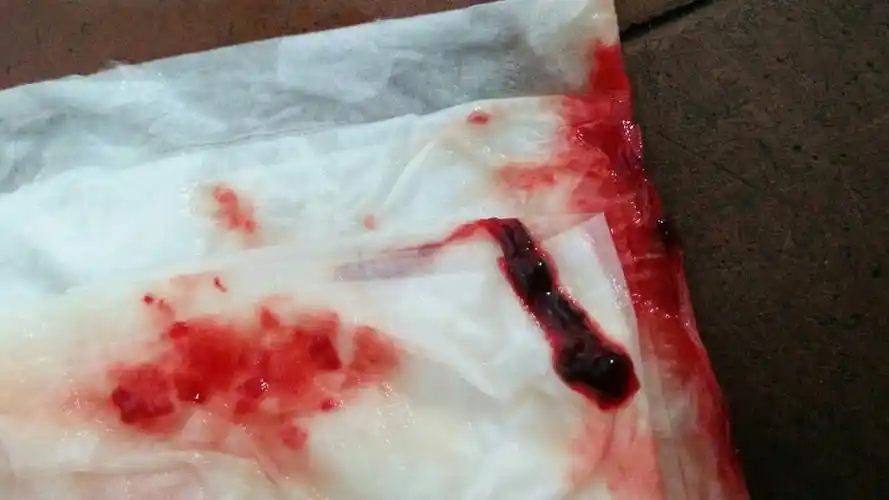 我女儿今年十三岁了,来月经时,下体流出了一些血条,不是血块,请问这