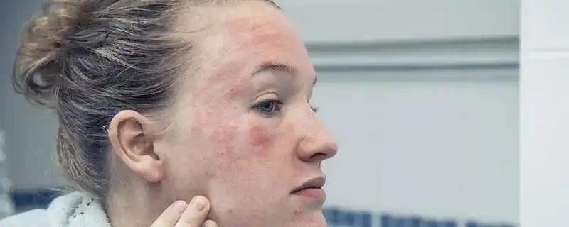 【敏感肌肤】敏感性皮肤用什么护肤品,敏感肌肤护肤品推荐_pclady百科