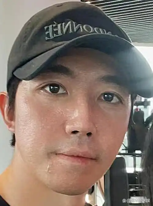 虽然距离烧伤已经过去十多年,俞灏明一直都在修复当中,每次拍戏也都扑